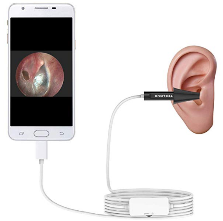 Stick a very small camera in your ear. Apparently. - Coolsmartphone